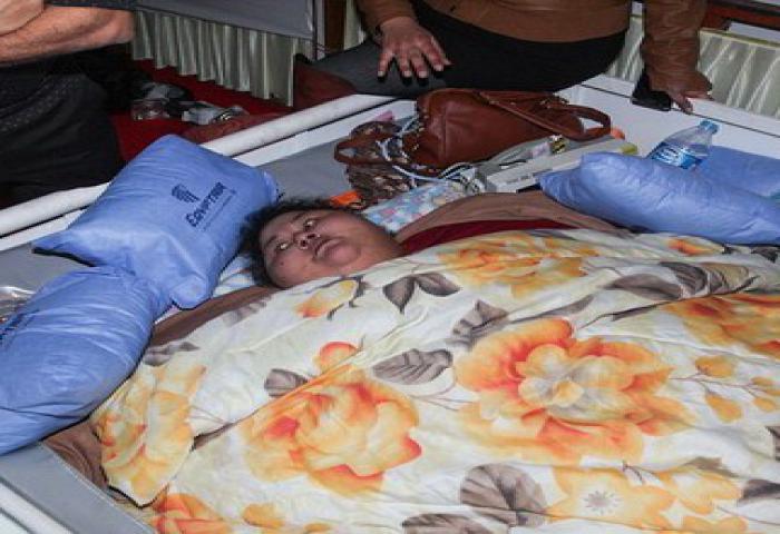 Tergemuk Sedunia, 25 Tahun Tak Bisa Bergerak